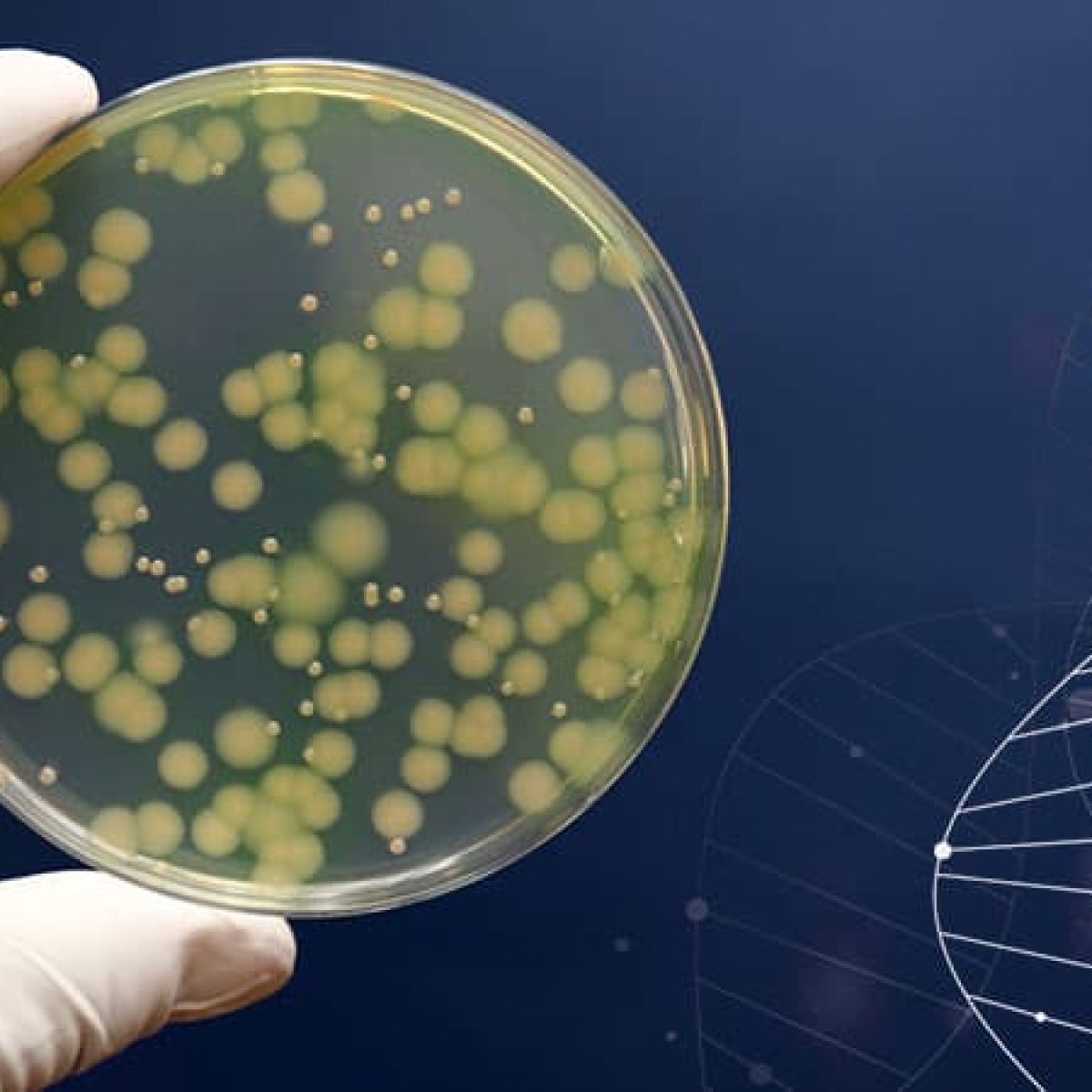 細菌の鑑別　緑膿菌　Pseudomonas aeruginosa